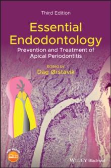 Essential Endodontology : Prevention and Treatment of Apical Periodontitis