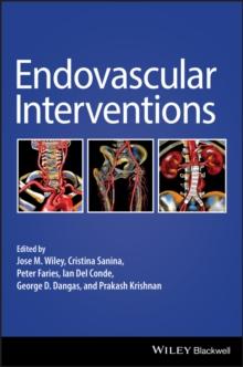 Endovascular Interventions