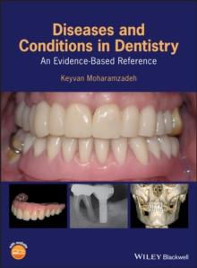 Diseases and Conditions in Dentistry : An Evidence-Based Reference