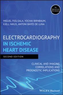 Electrocardiography in Ischemic Heart Disease : Clinical and Imaging Correlations and Prognostic Implications