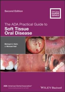 The ADA Practical Guide to Soft Tissue Oral Disease