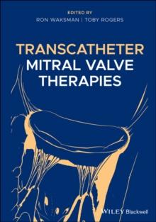 Transcatheter Mitral Valve Therapies