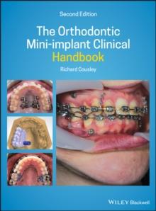 The Orthodontic Mini-implant Clinical Handbook