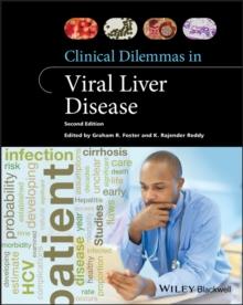 Clinical Dilemmas in Viral Liver Disease