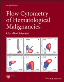 Flow Cytometry of Hematological Malignancies