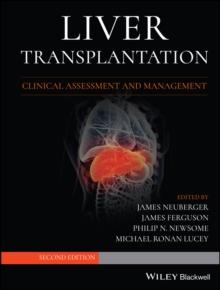 Liver Transplantation : Clinical Assessment and Management