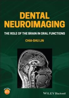 Dental Neuroimaging : The Role of the Brain in Oral Functions