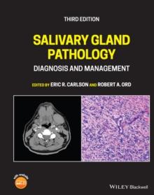 Salivary Gland Pathology : Diagnosis and Management