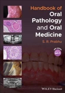 Handbook of Oral Pathology and Oral Medicine