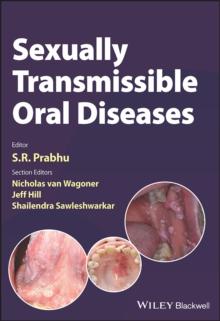 Sexually Transmissible Oral Diseases