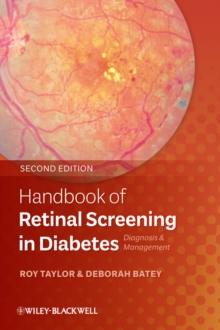 Handbook of Retinal Screening in Diabetes : Diagnosis and Management