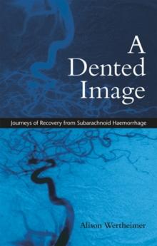 A Dented Image : Journeys of Recovery from Subarachnoid Haemorrhage