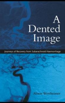 A Dented Image : Journeys of Recovery from Subarachnoid Haemorrhage