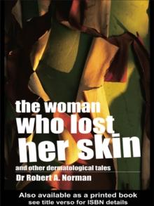 The Woman Who Lost Her Skin : (And Other Dermatological Tales)