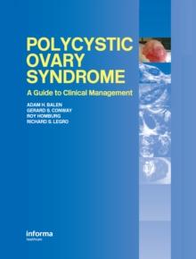 Polycystic Ovary Syndrome : A Guide to Clinical Management