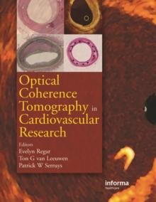 Optical Coherence Tomography in Cardiovascular Research