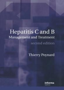 Hepatitis B and C : Management and Treatment