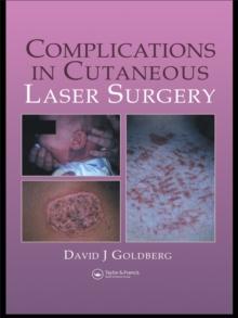 Complications in Laser Cutaneous Surgery