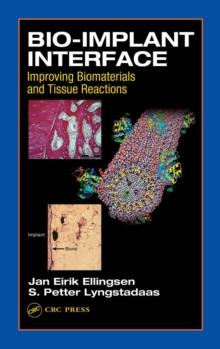 Bio-Implant Interface : Improving Biomaterials and Tissue Reactions