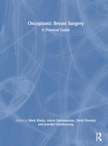 Oncoplastic Breast Surgery : A Practical Guide