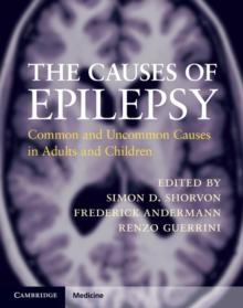 The Causes of Epilepsy : Common and Uncommon Causes in Adults and Children