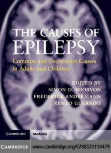 Causes of Epilepsy : Common and Uncommon Causes in Adults and Children