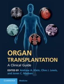 Organ Transplantation : A Clinical Guide