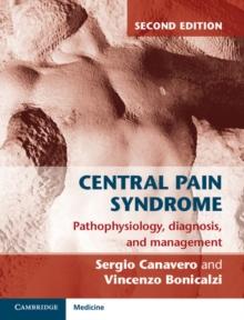 Central Pain Syndrome : Pathophysiology, Diagnosis and Management