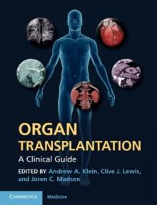 Organ Transplantation : A Clinical Guide