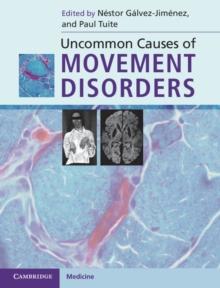 Uncommon Causes of Movement Disorders