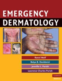 Emergency Dermatology