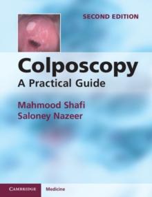 Colposcopy : A Practical Guide