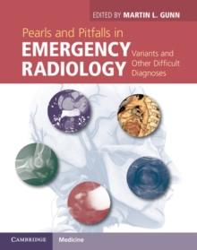 Pearls and Pitfalls in Emergency Radiology : Variants and Other Difficult Diagnoses