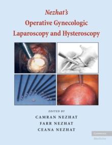 Nezhat's Operative Gynecologic Laparoscopy and Hysteroscopy