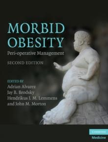 Morbid Obesity : Peri-operative Management