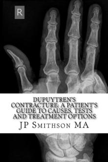 Dupuytren's Contracture: A Patient's Guide to Causes, Tests and Treatment Options