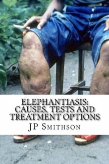 Elephantiasis: Causes, Tests and Treatment Options