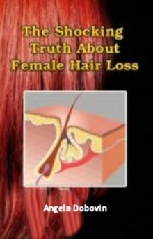 Shocking Truth About Female Hair Loss