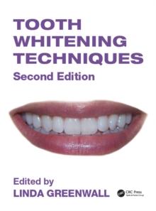 Tooth Whitening Techniques