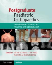 Postgraduate Paediatric Orthopaedics : The Candidate's Guide to the FRCS (Tr and Orth) Examination