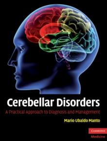 Cerebellar Disorders : A Practical Approach to Diagnosis and Management