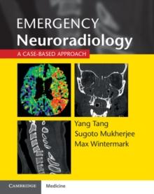 Emergency Neuroradiology : A Case-Based Approach