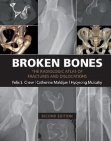 Broken Bones : The Radiologic Atlas of Fractures and Dislocations