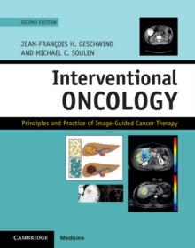 Interventional Oncology : Principles and Practice of Image-Guided Cancer Therapy