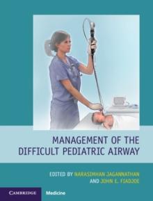 Management of the Difficult Pediatric Airway