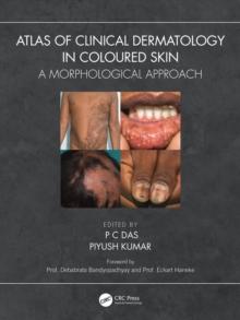 Atlas of Clinical Dermatology in Coloured Skin : A Morphological Approach