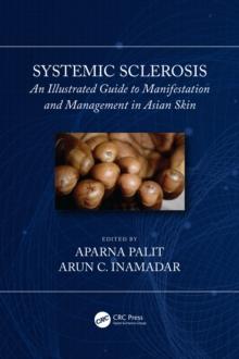 Systemic Sclerosis : An Illustrated Guide to Manifestation and Management in Asian Skin