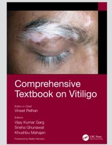 Comprehensive Textbook on Vitiligo