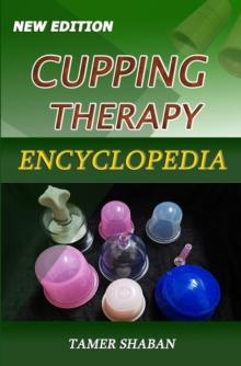 Cupping Therapy Encyclopedia - New Edition