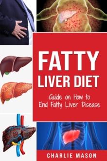 Fatty Liver Diet: Guide on How to End Fatty Liver Disease